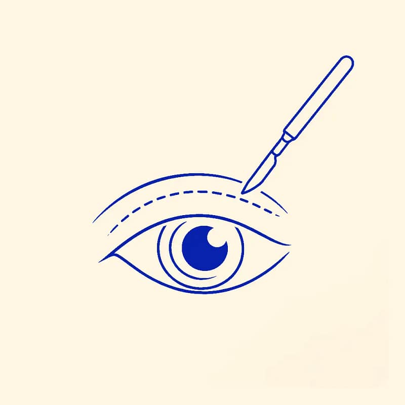 Icône d’un œil et d’un instrument chirurgical représentant la chirurgie des paupières