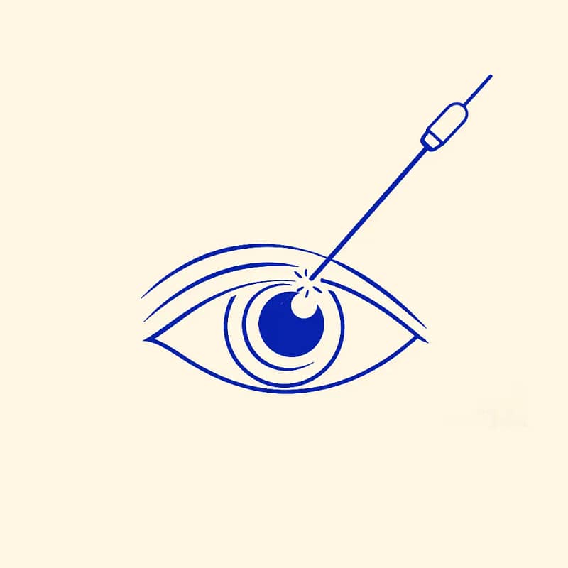 Icône d’un œil et d’un laser représentant la chirurgie réfractive